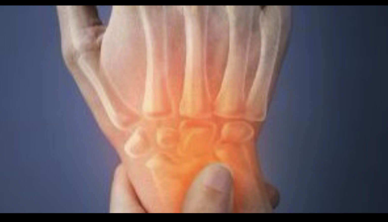 Arthritis Frontline ER Richmond